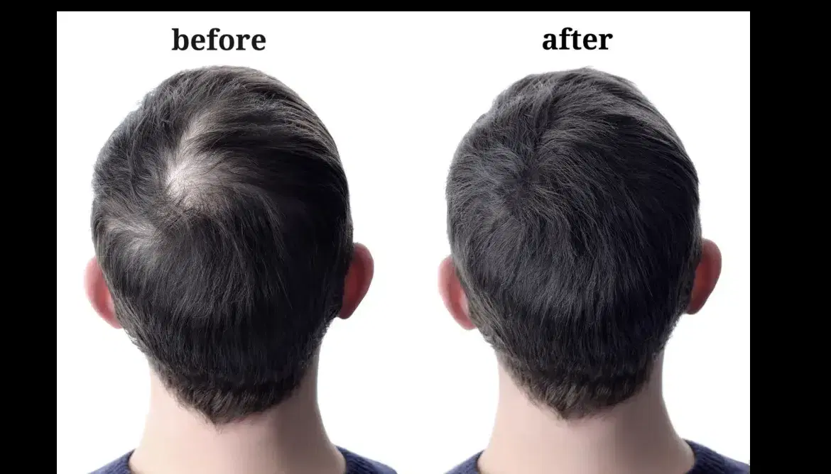 About Us Esthetic Hair