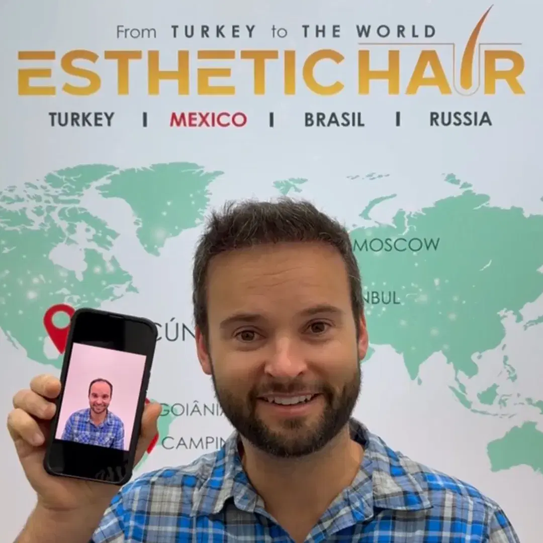 Cuidados después del trasplante capilar