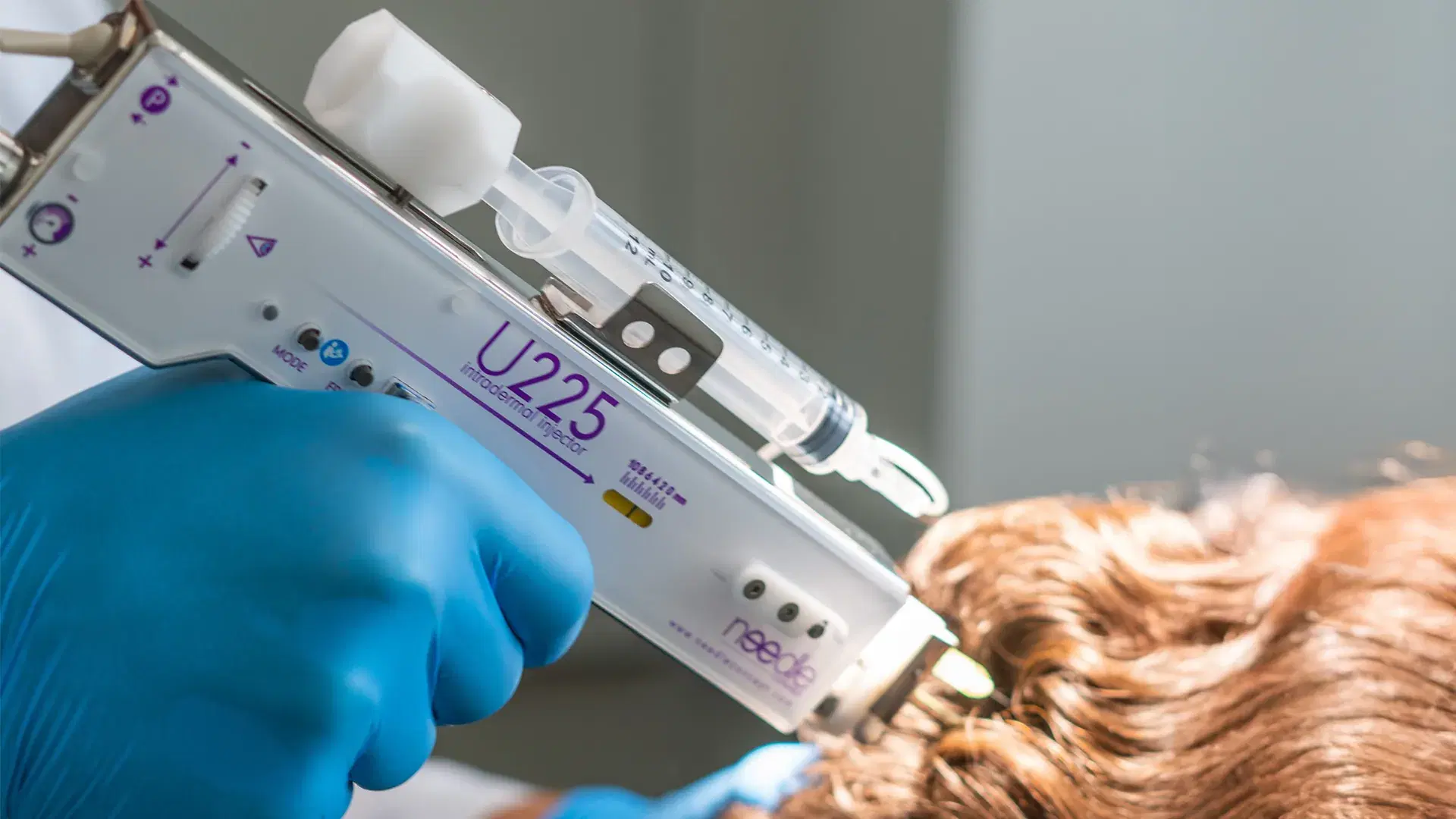 PRP Therapy Benefits for Hair