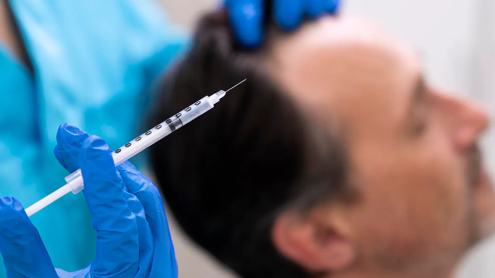 Benefits of Hair Mesotherapy