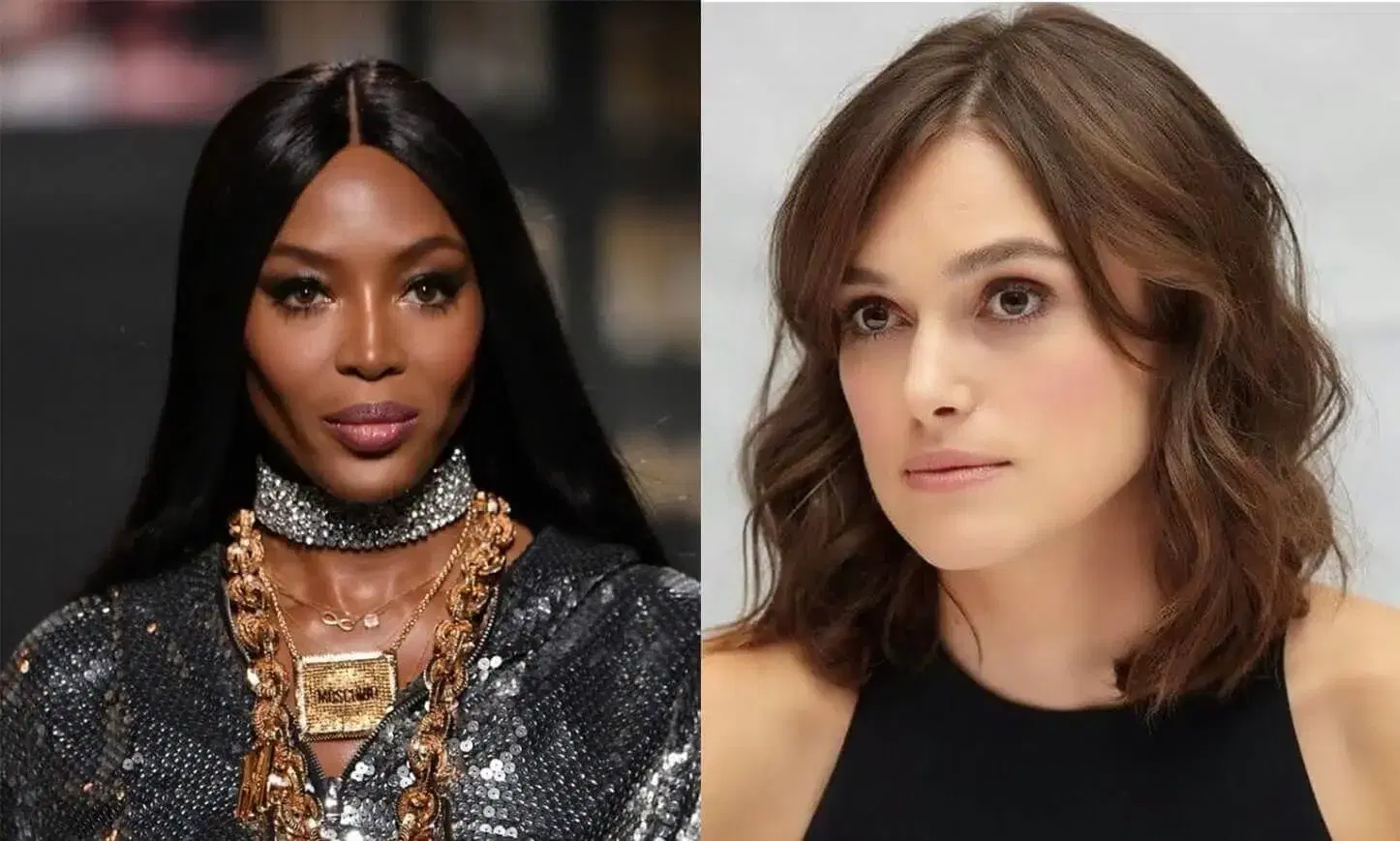 hair-transplant-female-celebrities