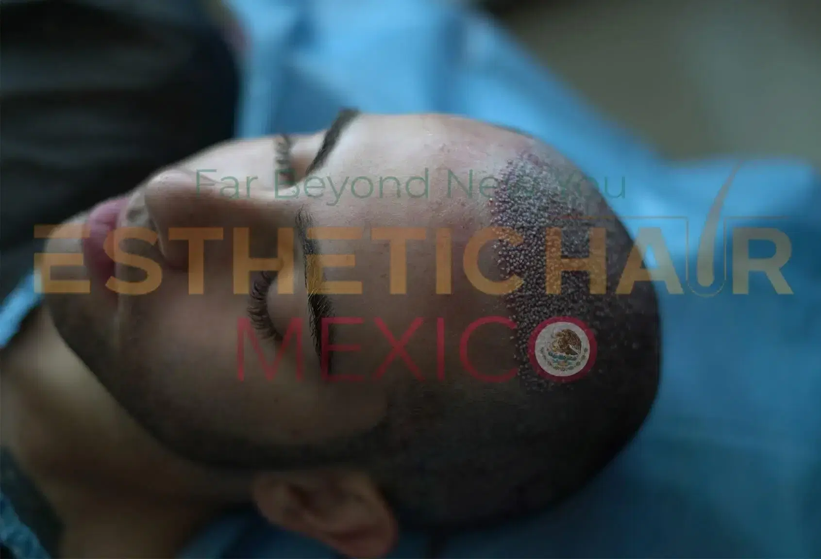 Sobre Nosotros Esthetic Hair