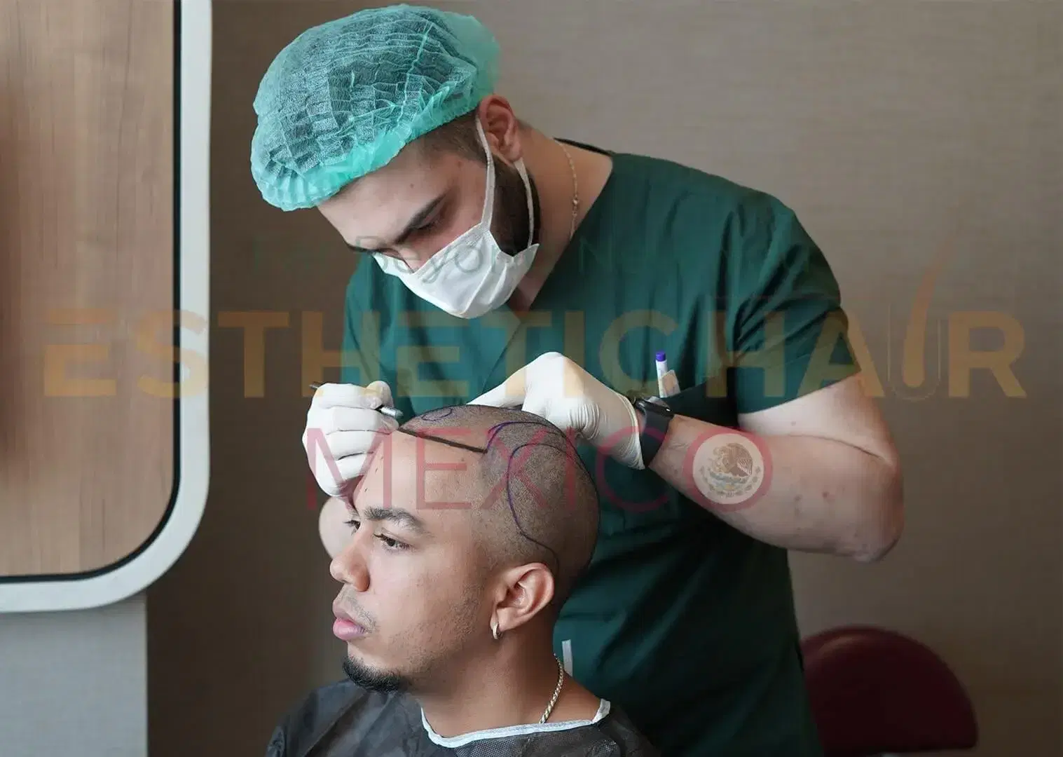DHI Hair Transplant